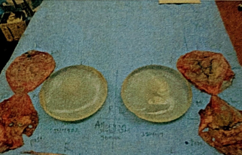 Trusting Your Gut and Taking Control: A Story of Advocacy in the Face of Breast Implant&nbsp;Illness